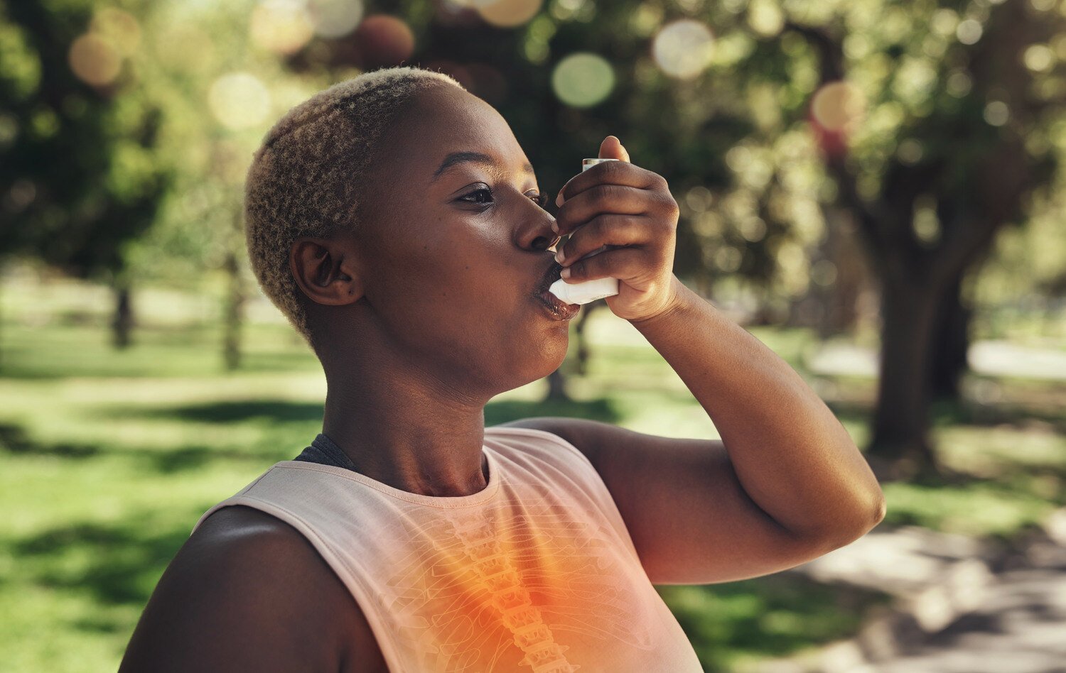 What You Should Know About Exercise-Induced Asthma